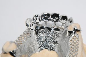 Scheletrica-con-ganci-caso-2_2