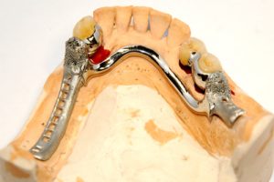 Soluzioni-in-combinata-caso-4_1